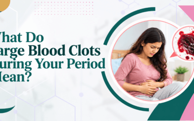 What Do Large Blood Clots During Your Period Mean?